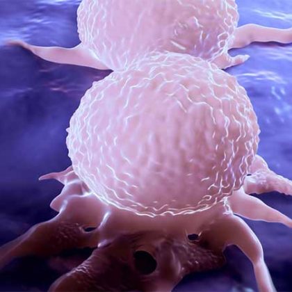 New Therapy Targets Breast Cancer Metastases in Brain