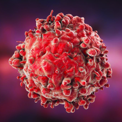 Newly Discovered Protein Explains Leukemia’s Treatment Resistance