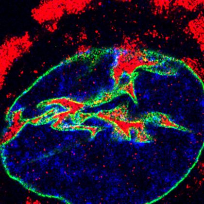 Uncovering the Cellular Mechanisms Behind Genetic Mutations in ALS