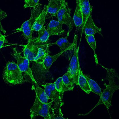 New Insights Into Role of RNA Methylation in Fragile X Syndrome