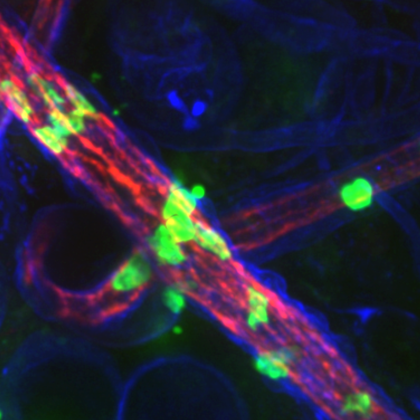 Newly Discovered Mechanism May Control Inflammation