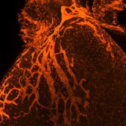 Rethinking Cardiac Repair After Injury