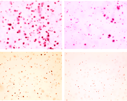 Inhibiting SAM Biosynthesis to Slow Tumor Growth