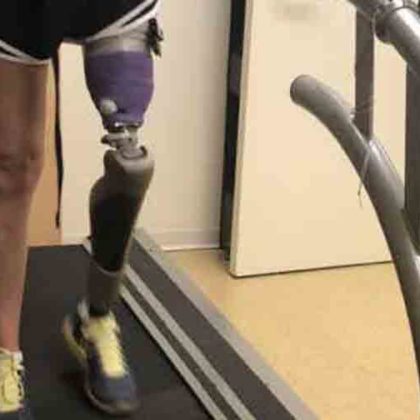 Novel Device Provides Continuous Monitoring of Skin, Prostheses