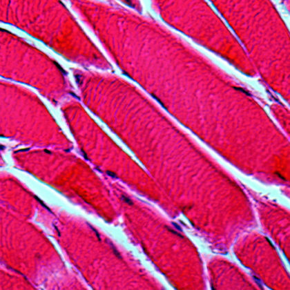 New Hope for Antibody to Treat Muscular Dystrophy