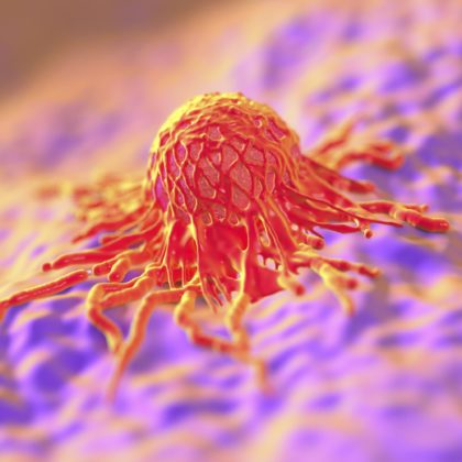 Recurring Brain Tumor Growth is Halted with New Drug