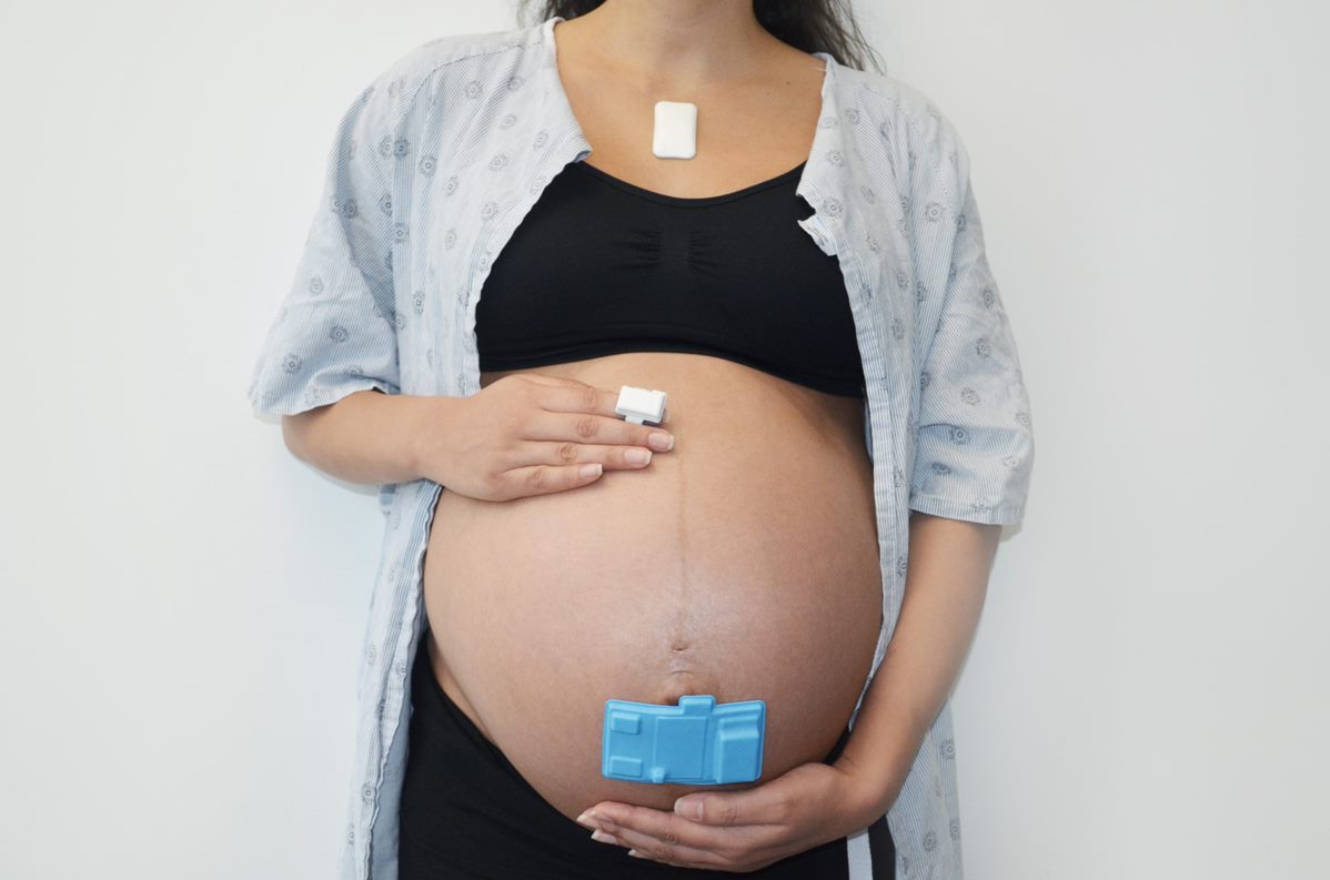 Northwestern Team Develops Wireless Monitors for Pregnant Moms, Chicago  News