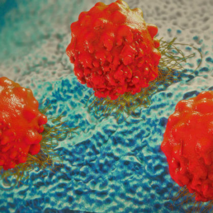 Emerging Therapy for Relapsed Lymphoma