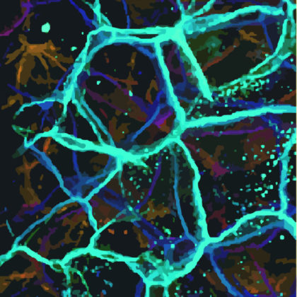 Novel Mechanisms Regulate Inflammatory Skin Diseases