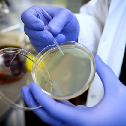 Understanding the Role of Octopamine in Neurodegeneration