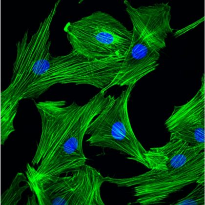 Investigating the Role of DNA Damage in Cardiac Hypertrophy