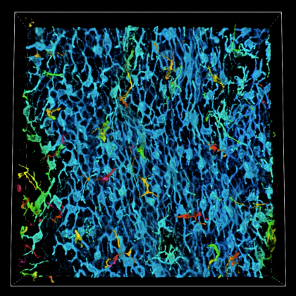 Novel Intercellular Signaling Mechanisms Promote Melanoma Growth