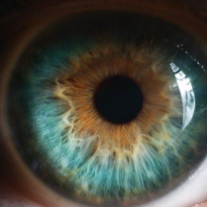 Genetic Mechanisms May Reveal Retinal Vascular Disease Therapeutic Targets