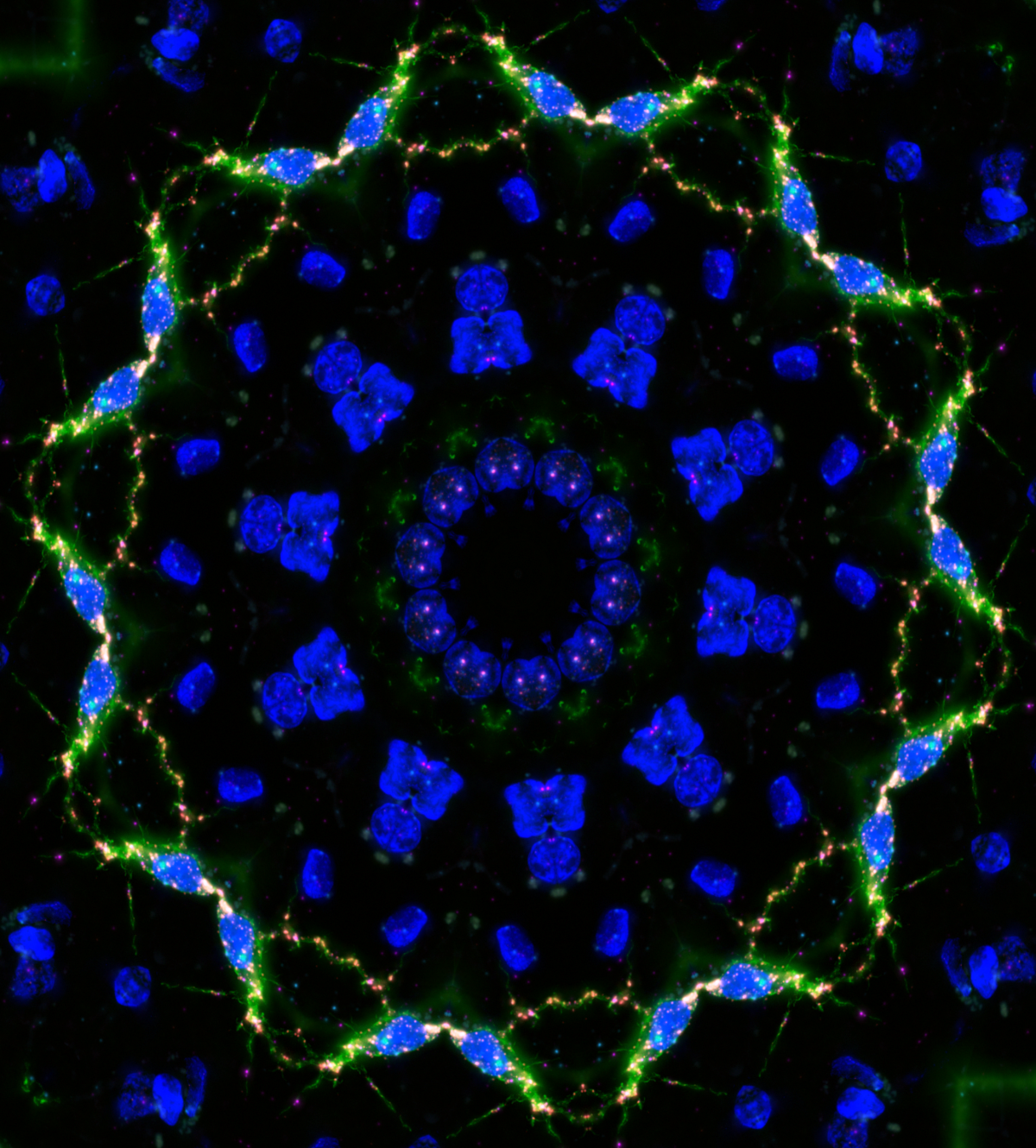 A stylized version of proinflammatory microglia