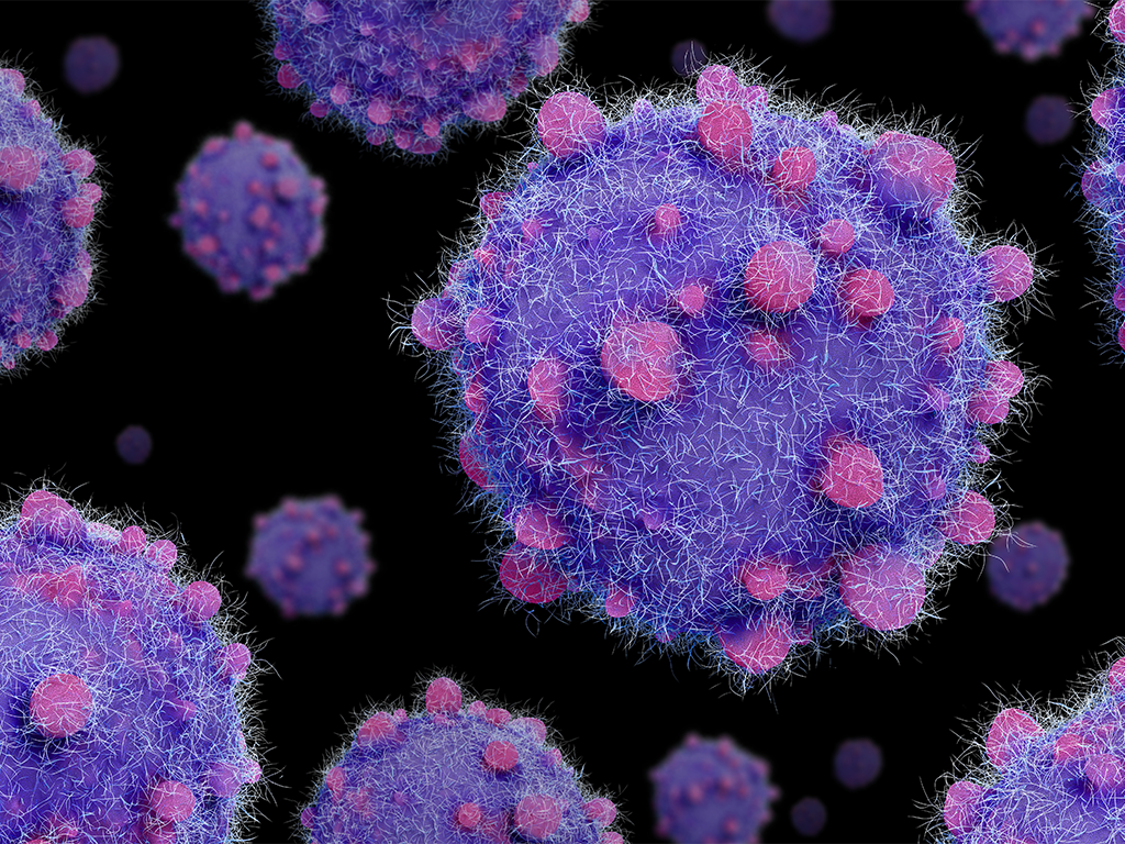 pancreatic cancer cells
