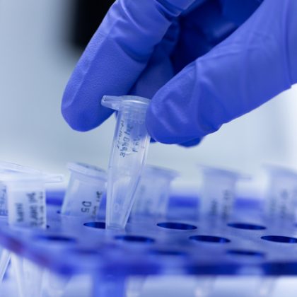First Gene Regulation Clinical Trials for Epilepsy Show Promising Results