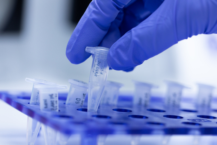 First Gene Regulation Clinical Trials for Epilepsy Show Promising Results